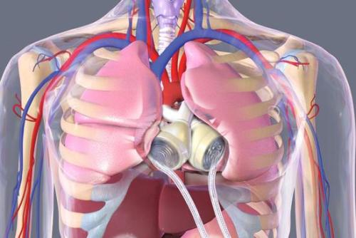 第一个3D工程血管化人类心脏生物打印