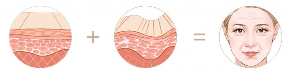 研究表明人类和其他哺乳动物之间的关键差异在于皮肤深层