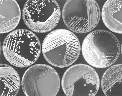 新系统使研究人员能够研究培养皿中微小组织内的细菌