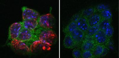 小鼠通过精子的表观遗传变化继承癌症易感性