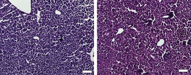 CRISPR / Cas9通过表观遗传调控沉默与高胆固醇水平相关的基因