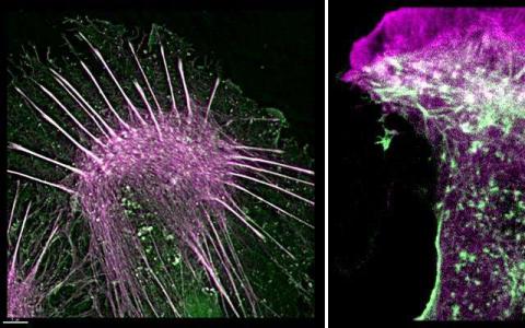 科学家们了解细胞如何运动的新方法