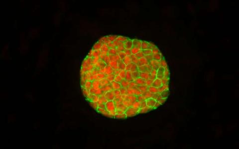 为什么男性和女性细胞在重新编程为干细胞后表现不同