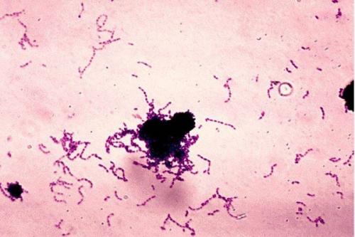 预防和治疗马链球菌感染的新指南
