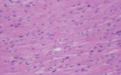 微管固定在核膜中的蛋白质位置肌细胞核