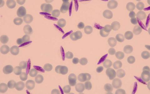 对寄生虫生物学的新认识可能有助于阻止疟疾传播