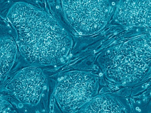 基因编辑方法产生完美的多能干细胞双胞胎