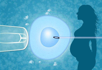 奥林巴斯的辅助生殖技术解决方案提高了ICSI的效率