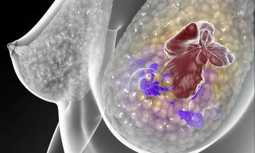 在小鼠中单一疫苗促使免疫系统对抗乳腺癌肺癌和皮肤癌