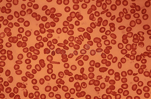 强调血细胞可能成为慢性疲劳的生物标志物