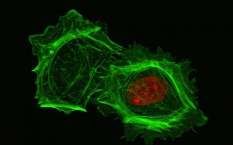 缺乏细胞核的细胞难以在3-D环境中移动