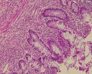 Gut-Nibbling Amoeba Evades检测Hannibal Lecter风格