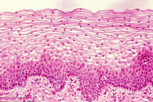 癌细胞利用内皮细胞间隙进行转移