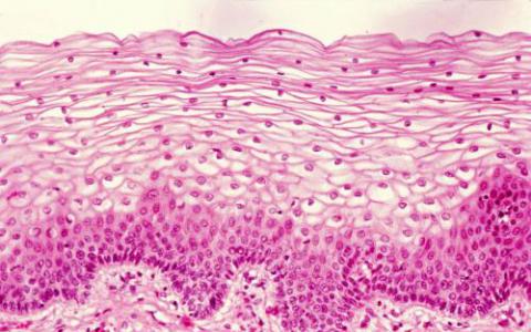 癌细胞利用内皮细胞间隙进行转移