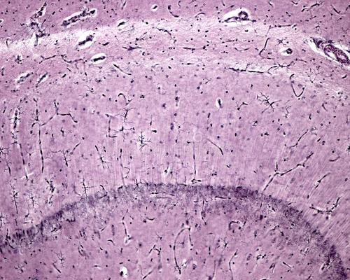 新一类小胶质细胞在神经退行性病变中的作用