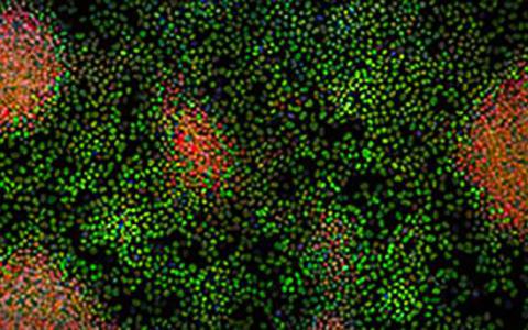 科学家们发现了将干细胞保持在未分化状态的蛋白质