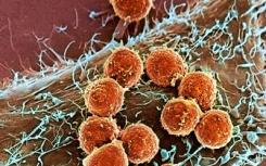 研究人员发现了抑制病毒诱发的癌症的新途径
