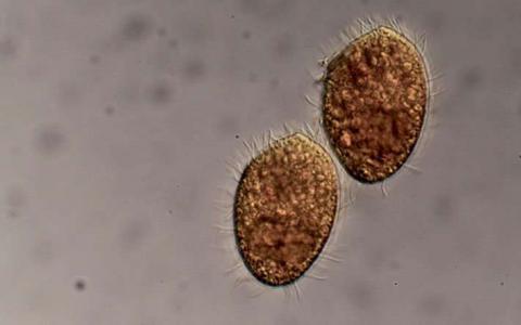 单细胞纤毛虫优选以微生物为食