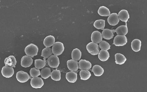 科学家发现抗击抗生素的潜在武器