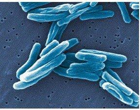 新研究发现分枝杆菌可以检测到导致疾病的蛋白质的存在