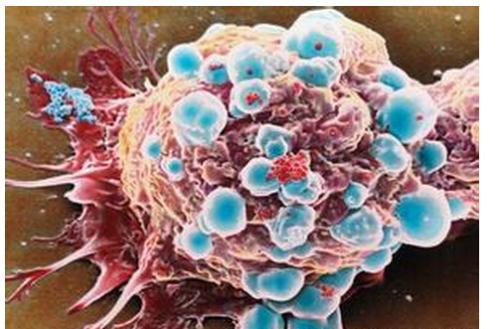 乳腺癌细胞系获得大数据援助