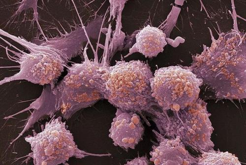 靶向CBM复合物导致T reg细胞引发肿瘤用于免疫检查点治疗
