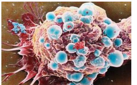 乳腺癌细胞系获得大数据援助