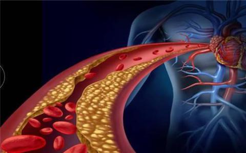 研究可以带来增加“好”胆固醇的策略