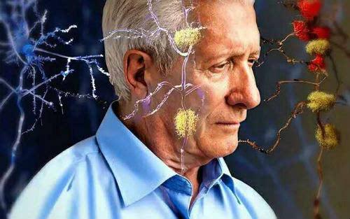 研究人员绘制了阿尔茨海默氏症的一个顽固的罪犯的分子结构和动力学图