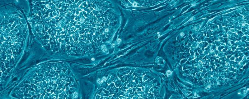 研究人员揭示了干细胞如何做出决定