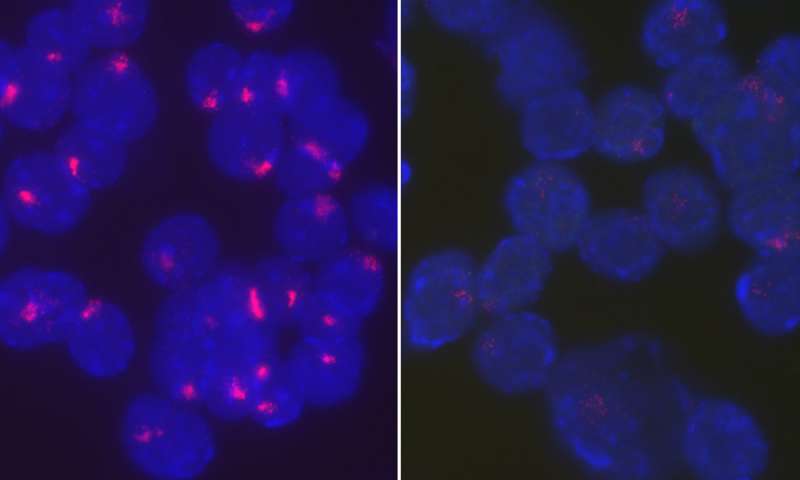 研究表明女性免疫细胞如何阻止其第二个X染色体