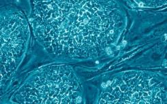 研究人员揭示了干细胞如何做出决定