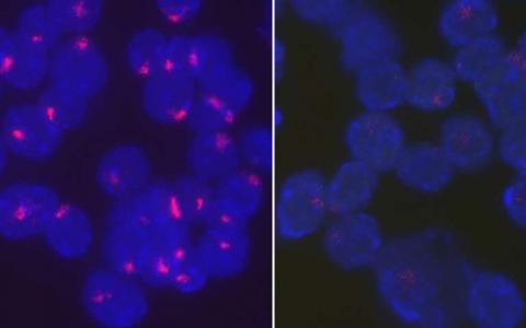 研究表明女性免疫细胞如何阻止其第二个X染色体
