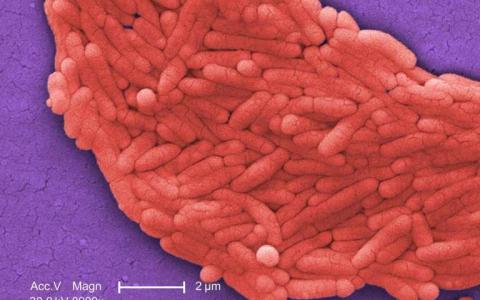 更快的沙门氏菌测试可提高人类和动物的食品安全性