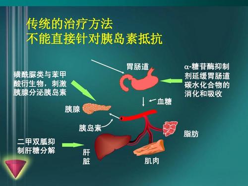 大型研究将罕见的DNA改变与2型糖尿病联系起来