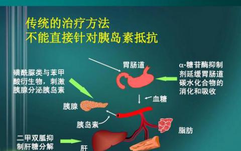 大型研究将罕见的DNA改变与2型糖尿病联系起来