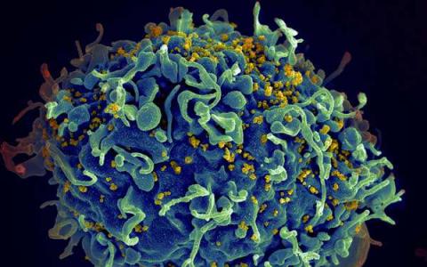 科学家们对艾滋病毒感染严重程度的遗传性提出了新的见解