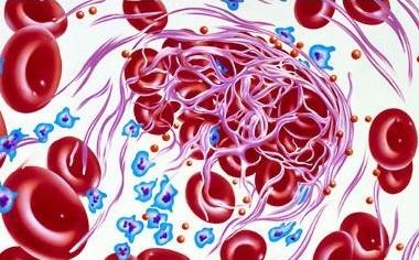 对抗凝血蛋白结构的研究可能为血栓形成的治疗开辟新的途径