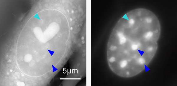 在海洋生物实验室发明的显微镜照亮染色体
