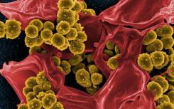 发现细菌会产生激活鼻窦中甜味受体的化合物从而导致感染