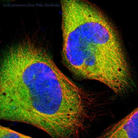 Human Cell Atlas希望揭开隐藏在我们基因中的神秘面纱