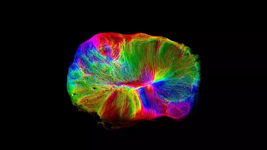 脑类器官增强复制人类大脑皮层生长