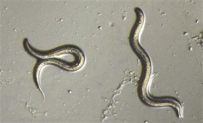 种系的表观遗传改变传达了对蠕虫后代的避免危险行为