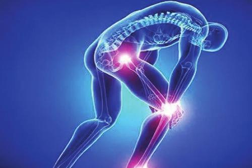 Bioventus和MTF Biologics合作开发用于膝关节骨性关节炎的胎盘组织产品