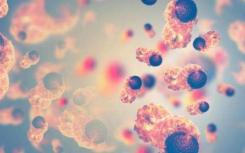 研究人员提出了关于ferroptosis在癌症发展中作用的新观点