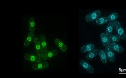 细胞如何控制核大小变得更加清晰-可以更好地了解癌症和衰老过程