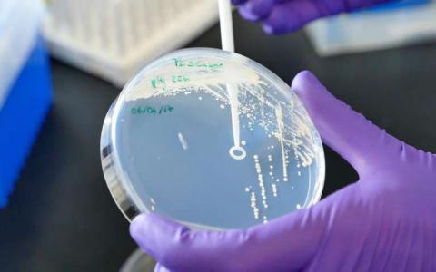 研究人员开发了基于酵母的工具用于全球病原体检测