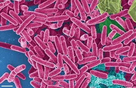 研究人员发现美国最后一种抗生素对沙门氏菌具有抗药性