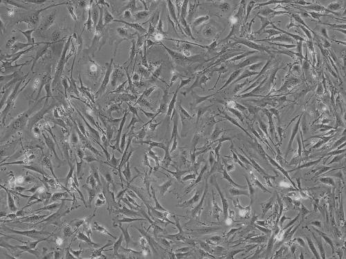 成纤维细胞亚群帮助癌症逃避免疫系统