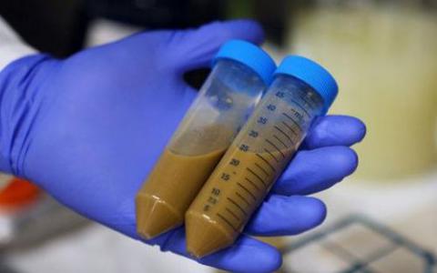 FDA暂停涉及粪便移植的临床试验